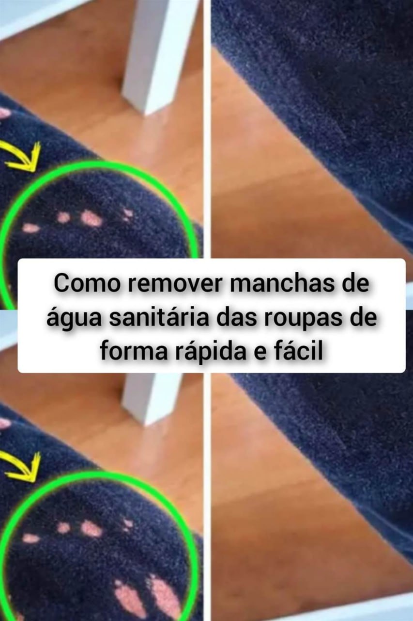 Como remover manchas de água sanitária das roupas